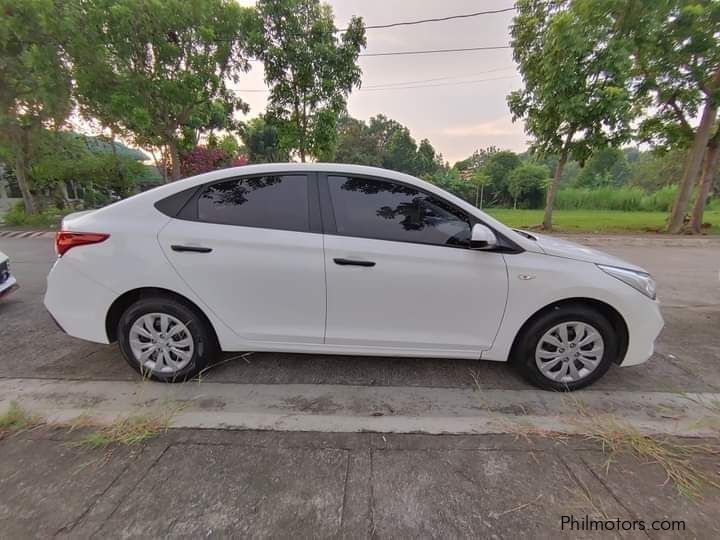 Hyundai Accent in Philippines